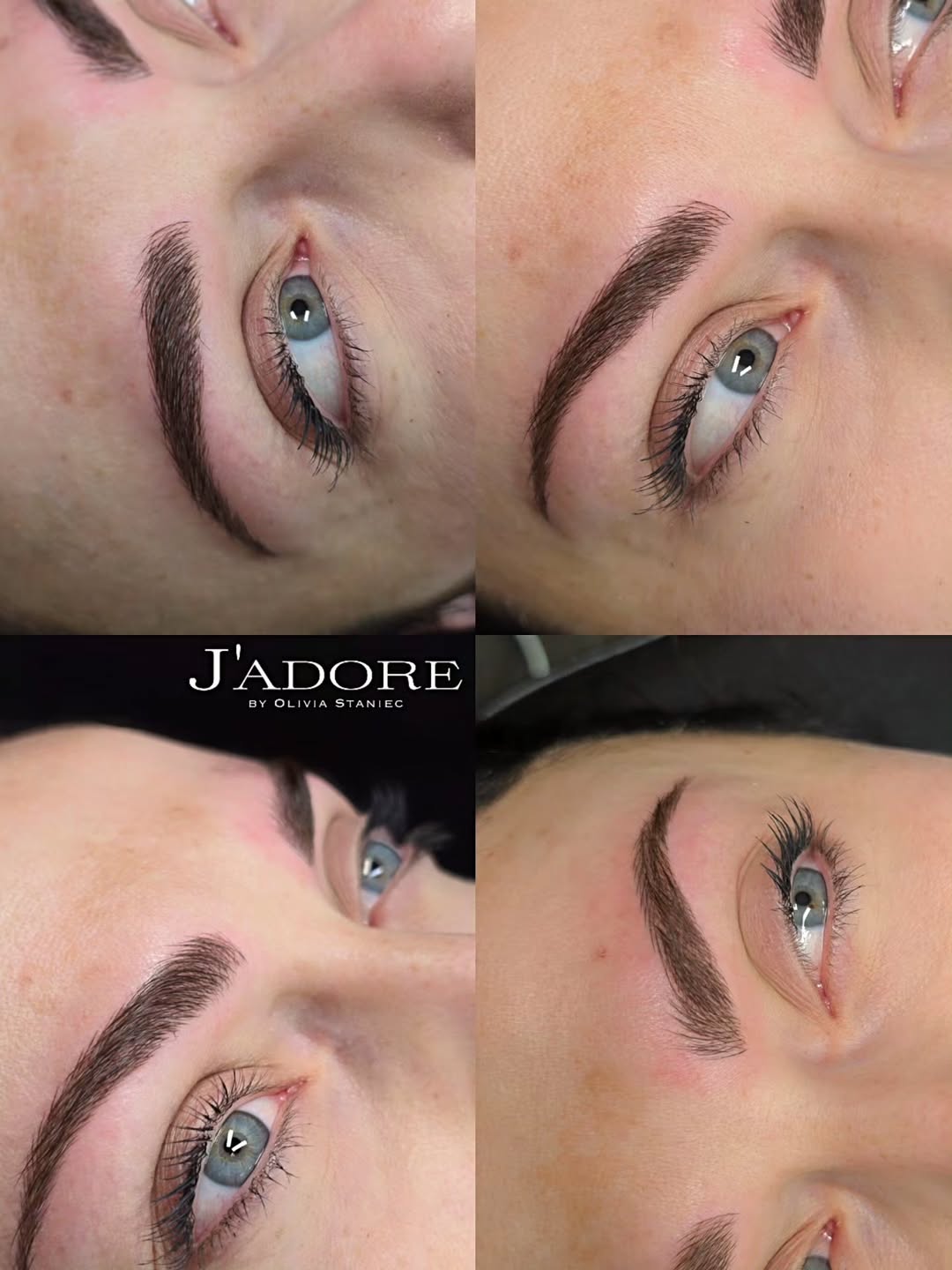 Browlifting Detail